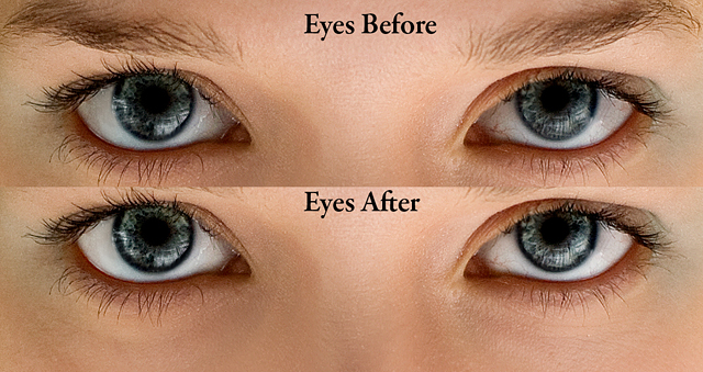 Iris Color
