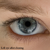 Step 3 Eye